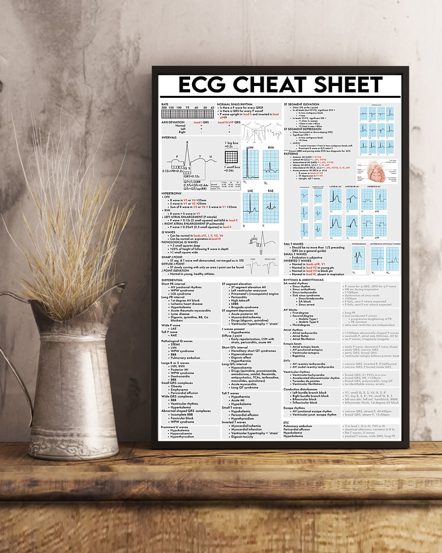 ecg cheat sheet cardiologist poster 3